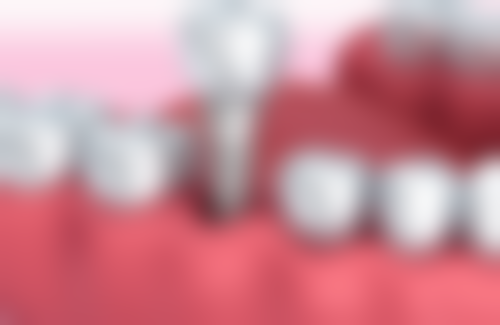 十堰美盛口腔门诊部方丽医生价格收费表查询