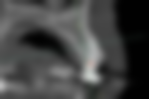 郑州市管城区乐尚口腔上班时间：