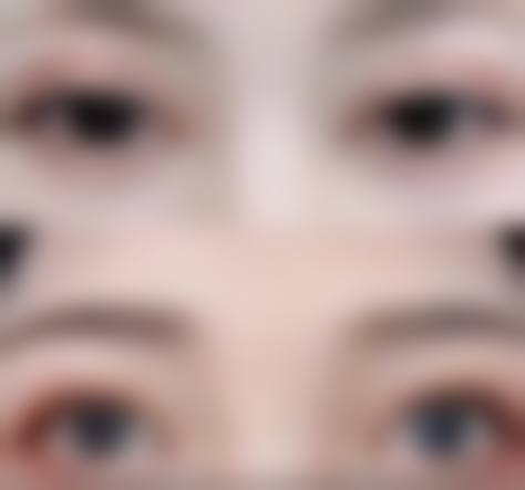 医疗保险报销的申请流程及注意事项