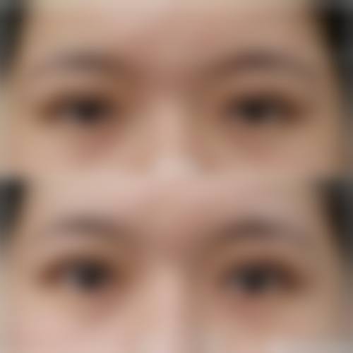 威海克拉医疗美容诊所医保能报销吗？普通项目自付，治疗性项目部分合规可报 