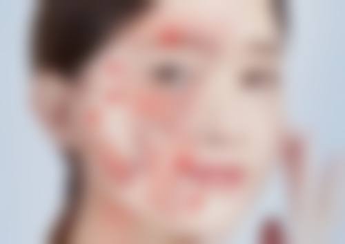 成都玉之光医疗美容医院患者评价