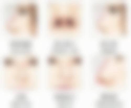 长沙丽芊省府整形医院患者评价