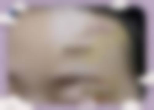 成都新生植发医院交通路线与预约