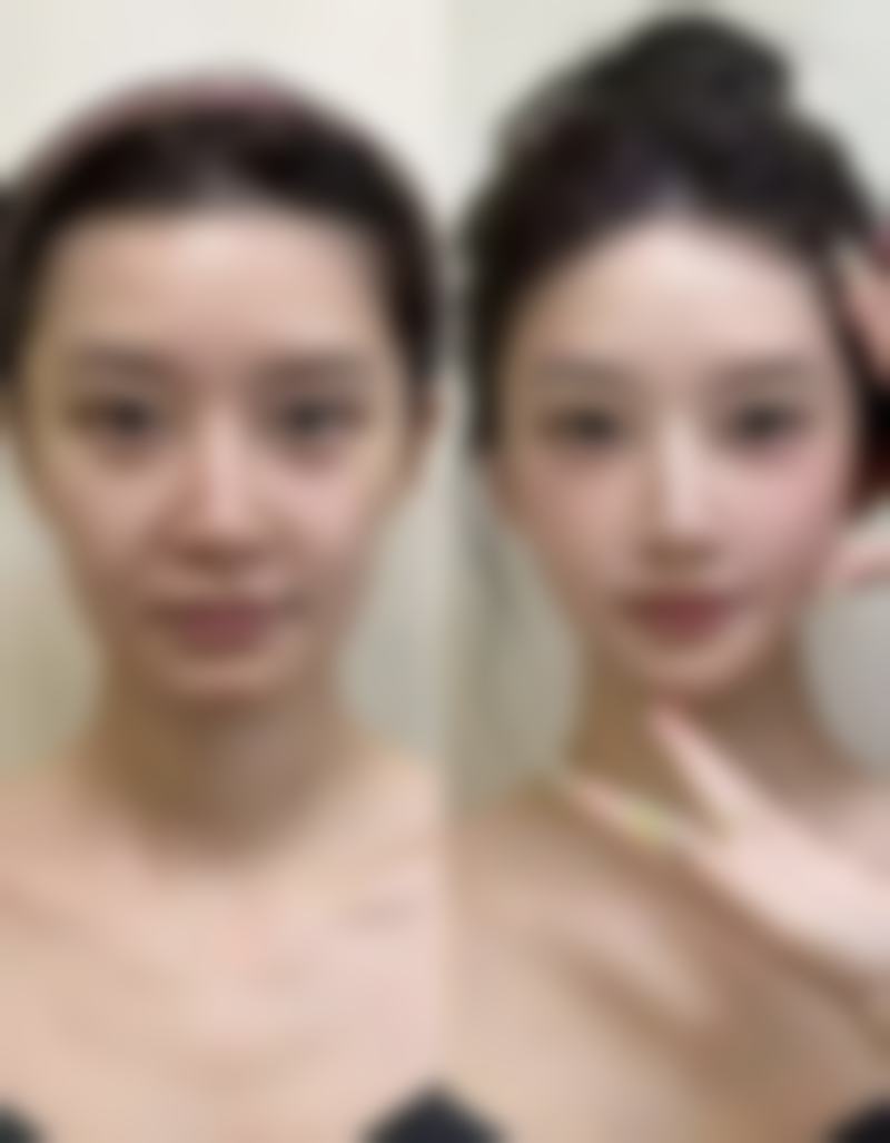 兰久利技术水平评价