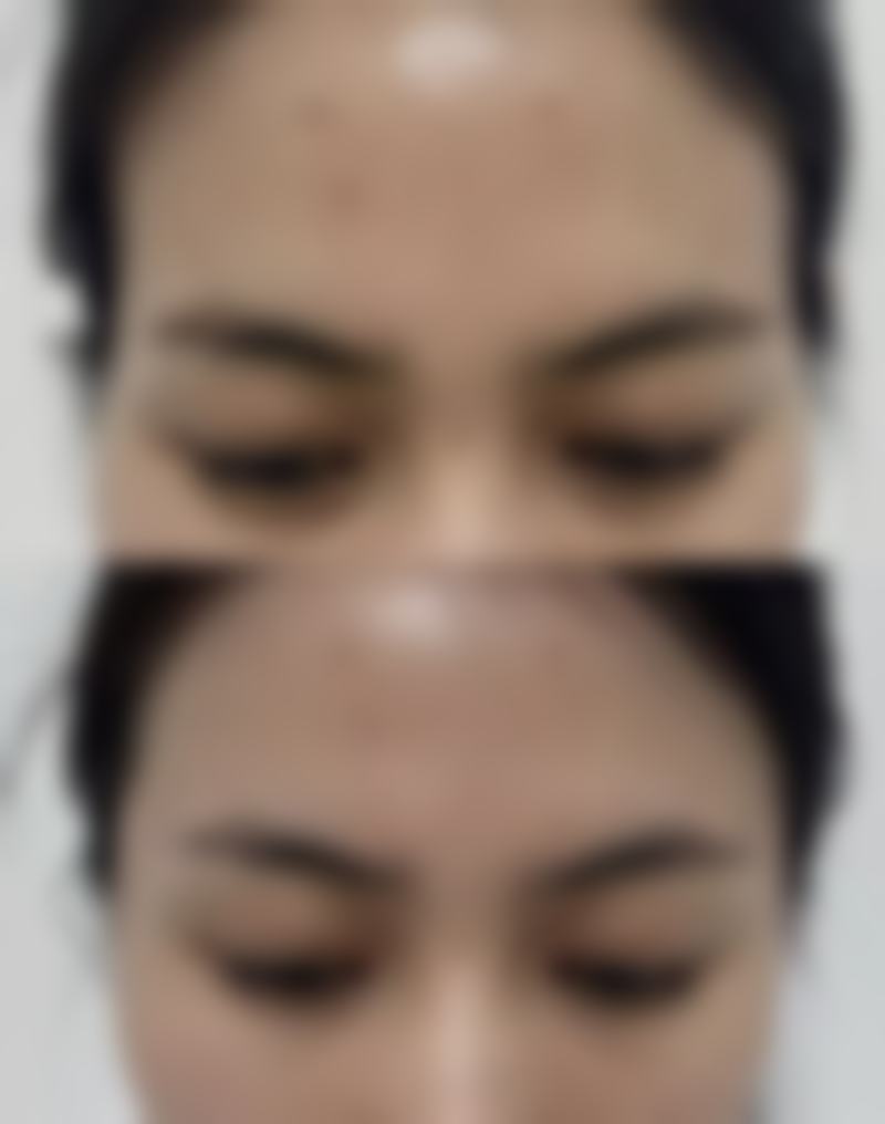 兰久利预约方式