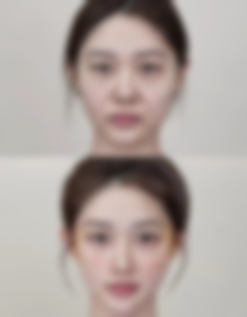 襄阳雅美医疗美容门诊部患者评价