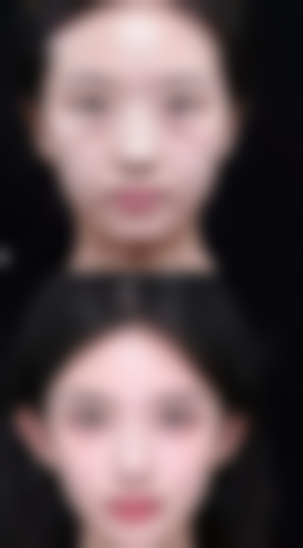 北京鹏爱整形医院患者评价