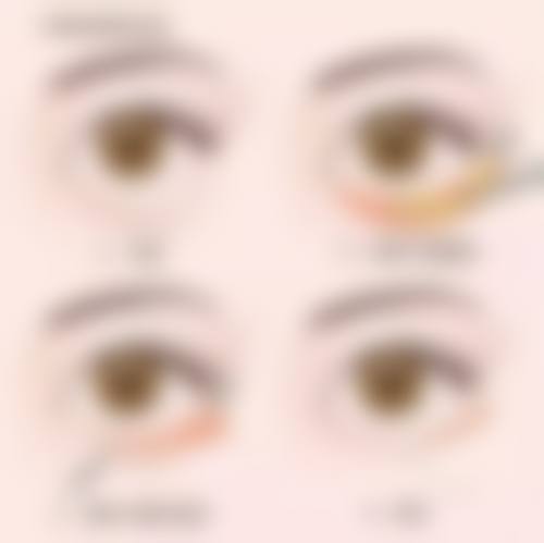 韩国VAVA整形外科医院核心项目