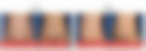 新疆威兹曼医疗美容医院（原新疆整形美容医院）核心项目