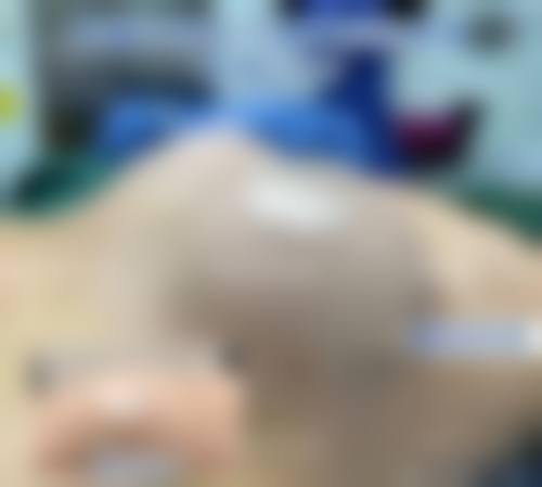 POP 整形外科患者评价