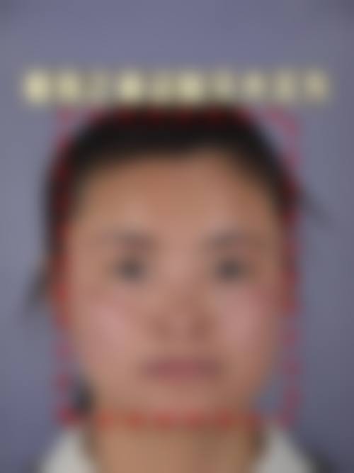 深圳柏悦医疗美容门诊部患者评价