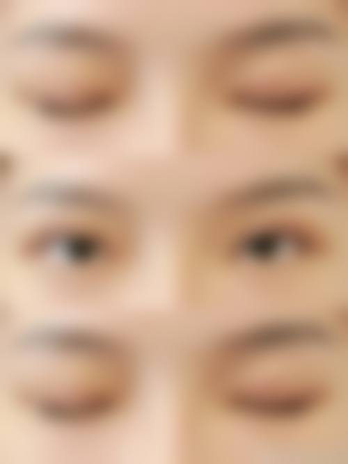 韩国VAVA整形外科医院价格参考