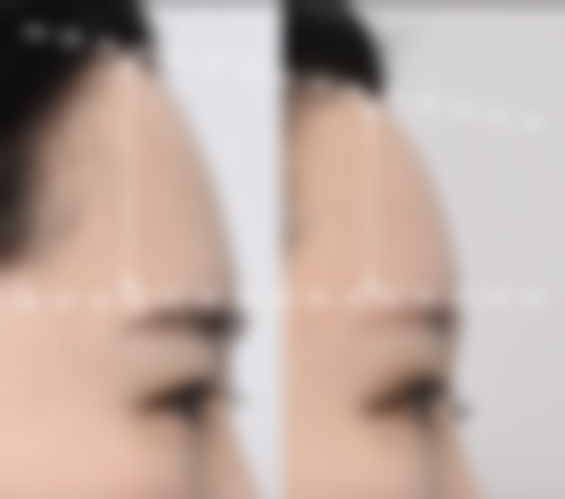 北京兰乔整形医院正规资质