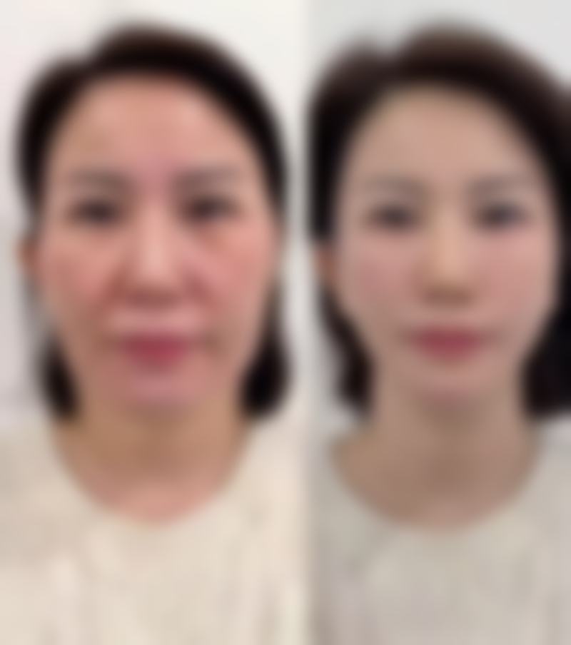 陈仕伟患者评价