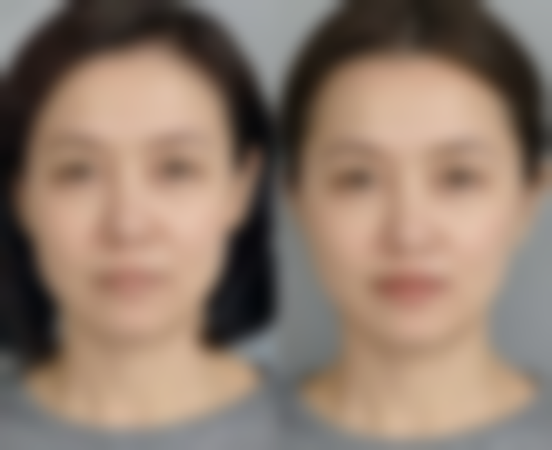 兰久利患者评价