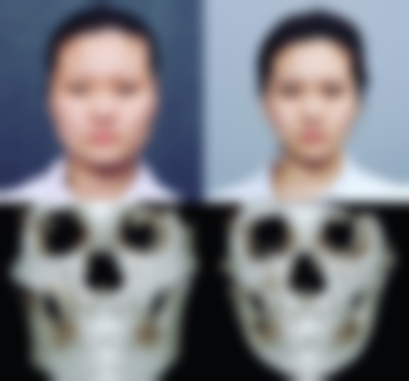 丁文婷患者评价