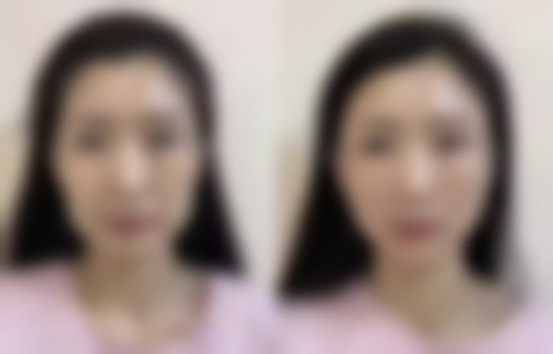 北京兰乔整形医院交通路线与预约