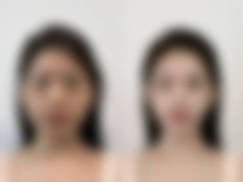 嘉兴海宁时光整形美容诊所价格参考