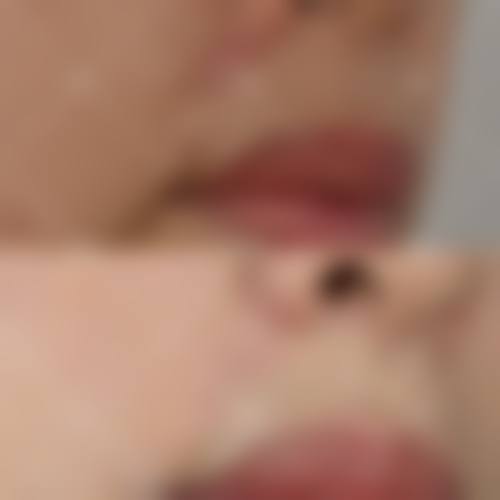 宝鸡韩美整形医院核心项目