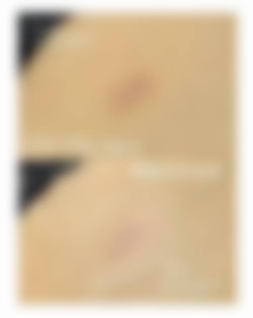 宝鸡韩美整形医院价格参考