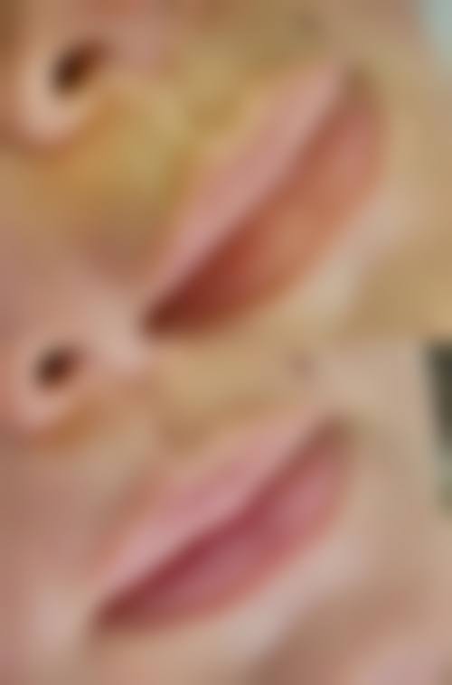 金允珍擅长项目列表