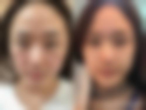 无锡素氏柔医美整形医院价格参考