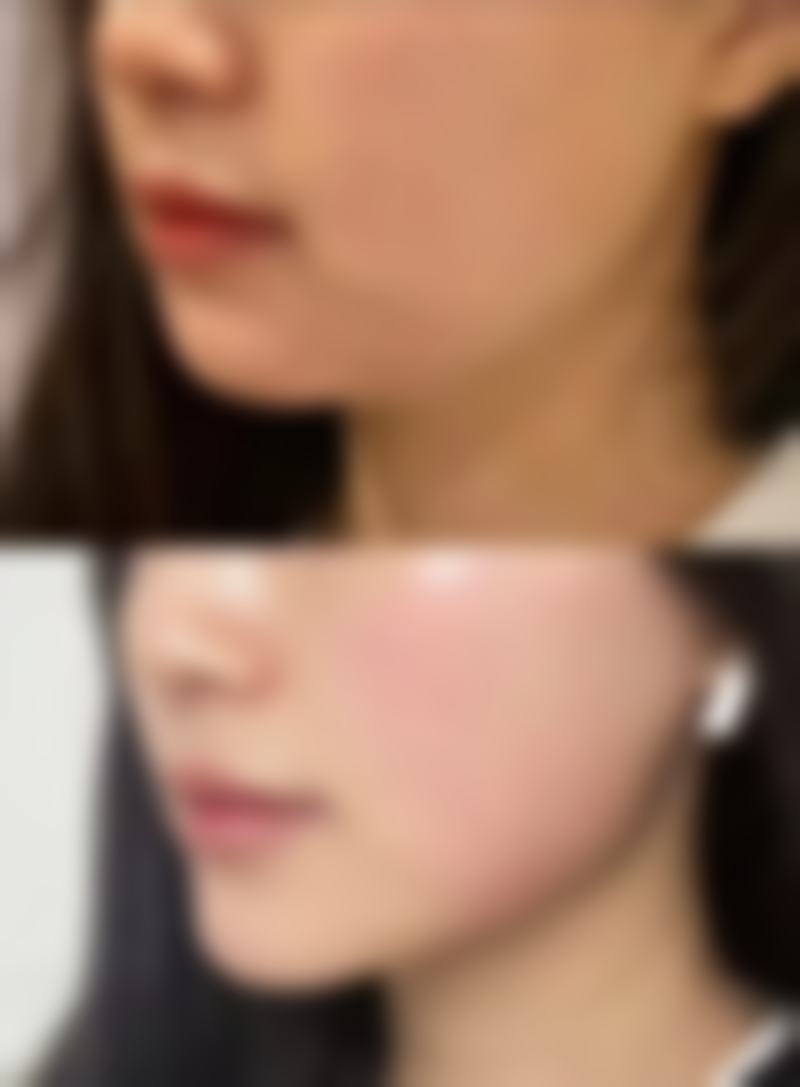 南昌马克整形医院交通路线与预约