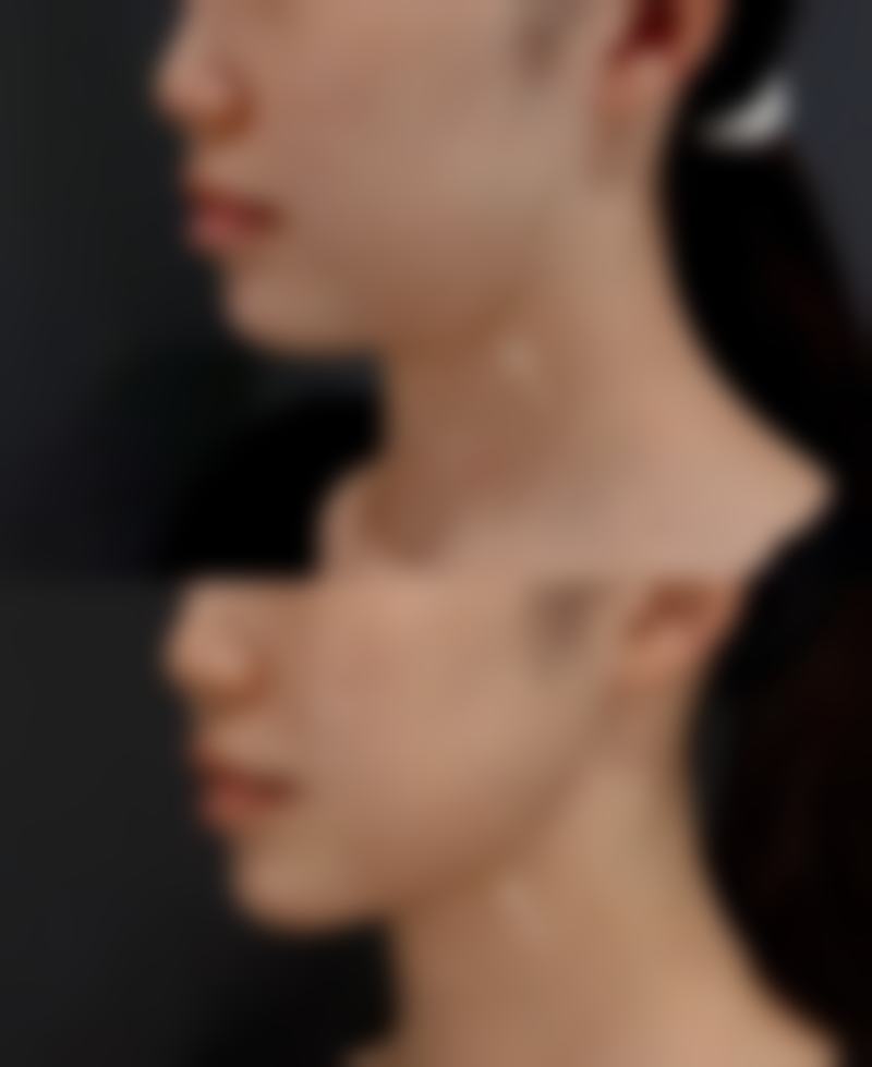 韩国 shine beam 皮肤科 大田店患者评价