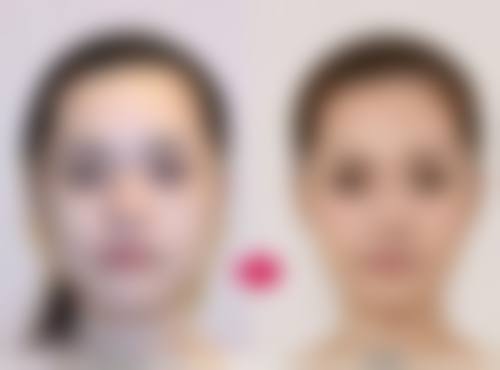 黄山祁门县人民医院整形美容科正规资质