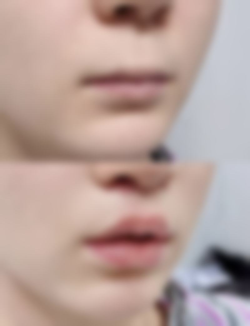 中山医《家庭医生》整形美容医院核心项目