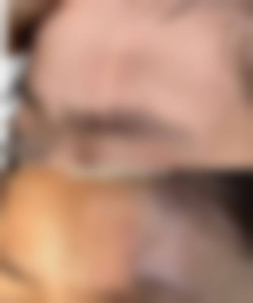 解放军第175医院烧伤整形科核心项目