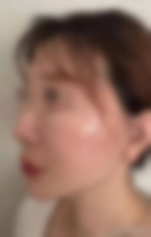 漯河源汇区人民医院整形科价格参考