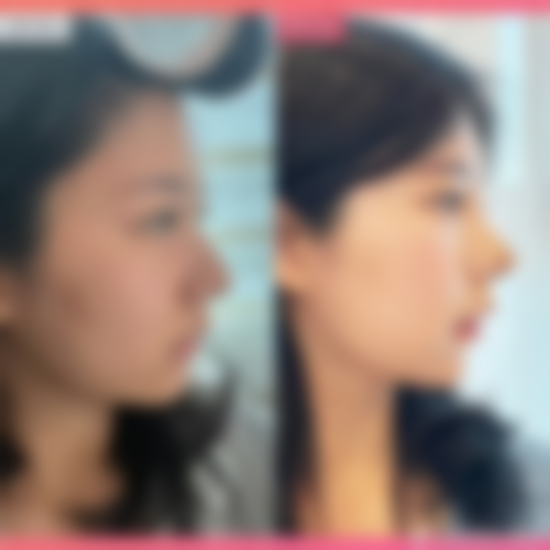 韩国优雅人整形医院