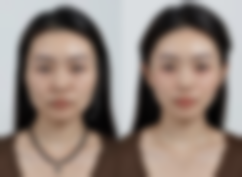 上海瑞欧整形医疗美容门诊部核心项目