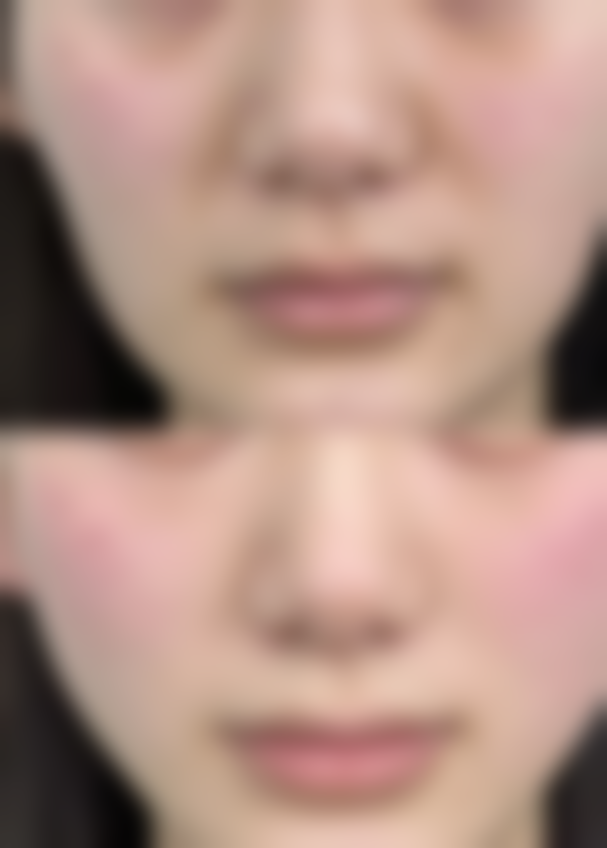 郑州金水区秋涛医学美容诊所核心项目