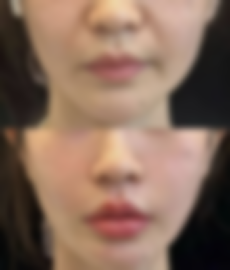 汕头陈静医学整形美容正规资质