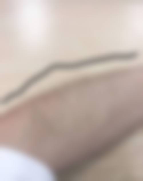 长沙伍柒笙泽植发医院患者评价