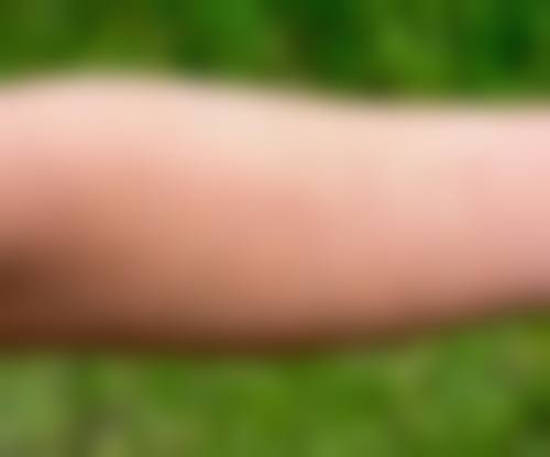 淮安高第植发医院核心项目