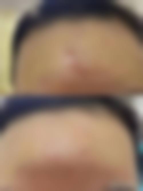 唐山创美微整形医院正规资质