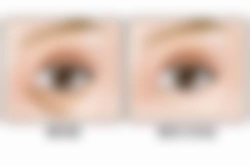 韩国天鹅（The Swan）整形外科价格参考