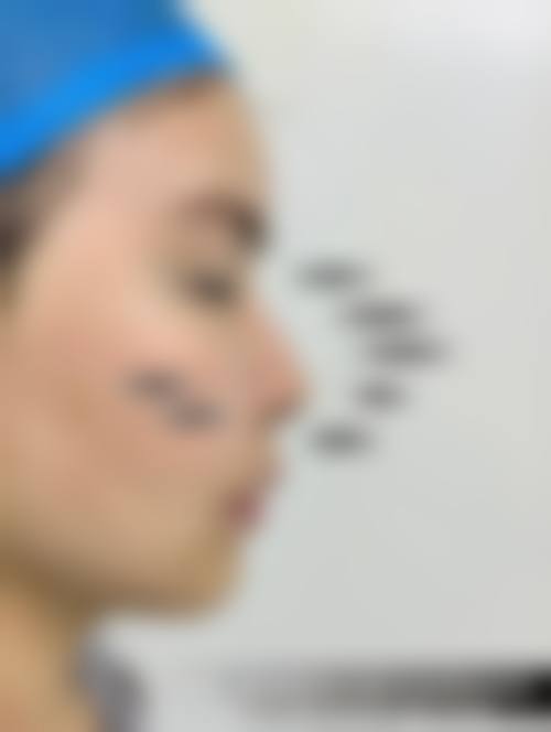 罗澜涛患者评价