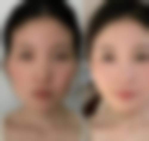 陈红梅患者评价