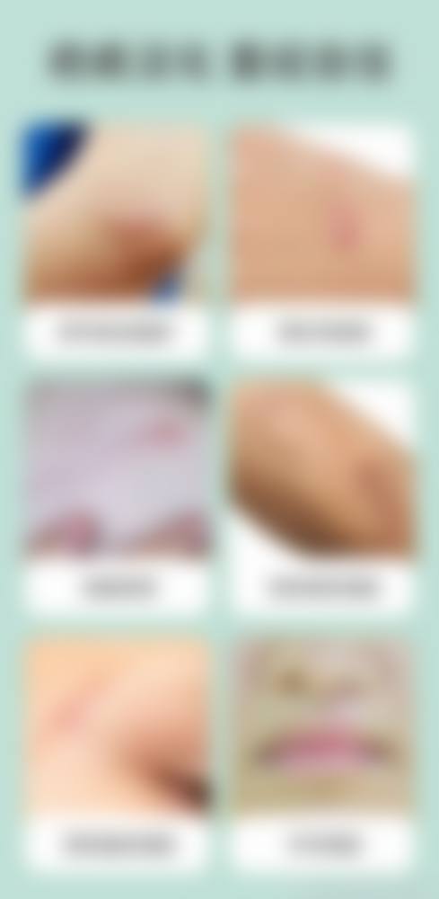 泰州人民医院烧伤整形科核心项目