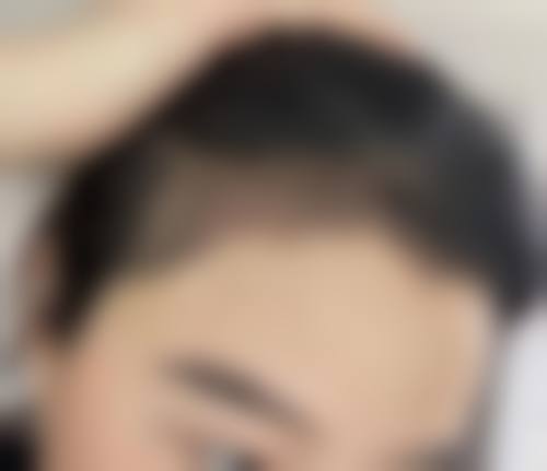 江西抚州薇琳整形患者评价