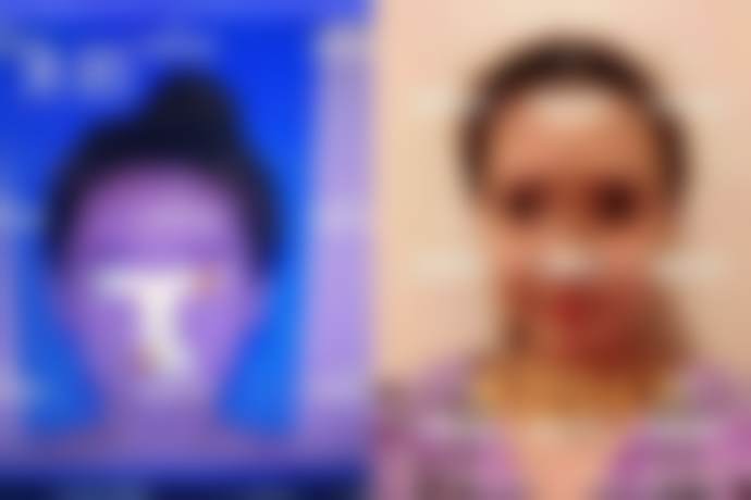 金明镇擅长项目列表