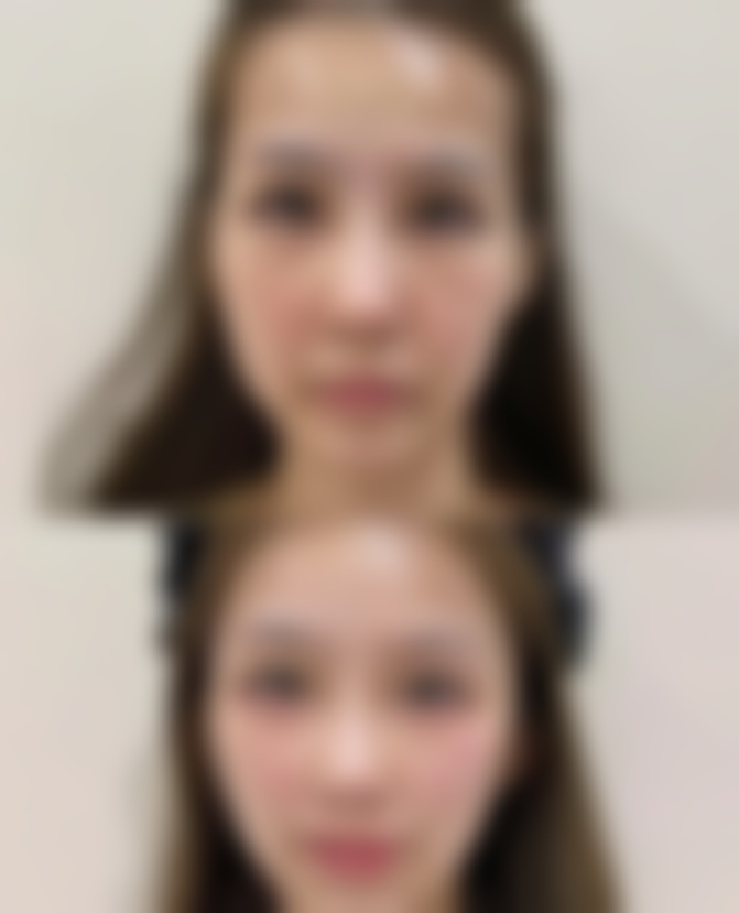 嘉兴欣慕整形医院交通路线与预约