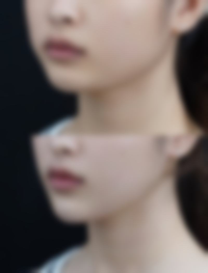 韩国天鹅（The Swan）整形外科核心项目