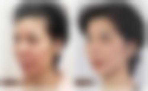 漳州华美紫馨整形医学美容门诊部患者评价