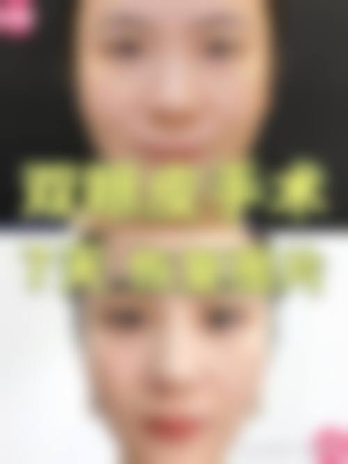 湖州月集医疗美容诊所患者评价