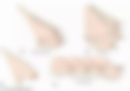 昆明医 科 大学第二附属医院(整形外科)医生团队